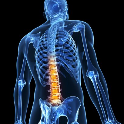 Blokáda medzistavcových kĺbov v oblasti driekovej chrbtice a bedrovokrížového kĺbu